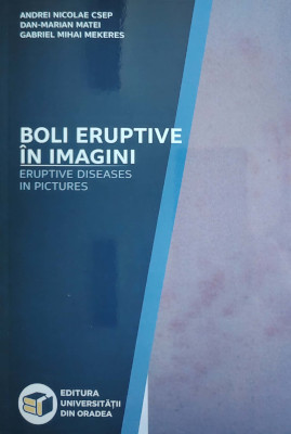 Boli eruptive în imagini / Eruptive Diseases in Pictures