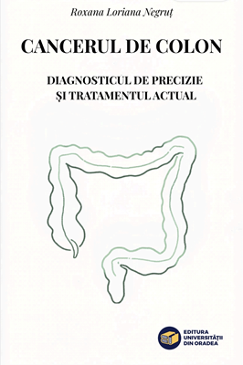 Cancerul de colon. Diagnosticul de precizie și tratamentul actual
